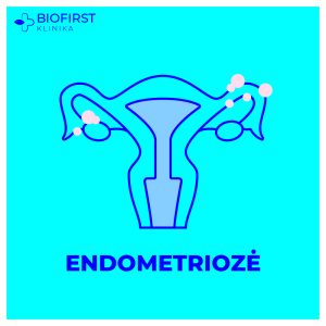 endometrioze