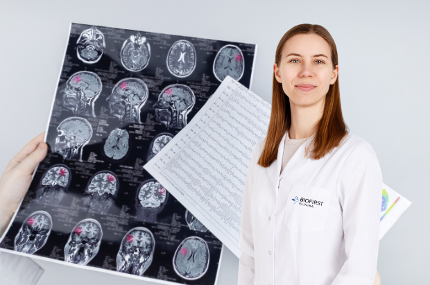 Epilepsija_BIOFIRST klinika