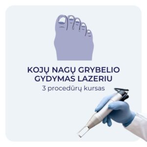 Kojų nagų grybelio gydymas lazeriu