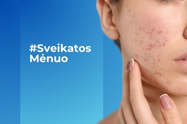 Spec. pasiūlymas_probleminės odos ištyrimo programa