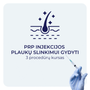 PRP injekcijos plaukų slinkimui gydyti