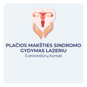 Plačios makšties gydymas lazeriu