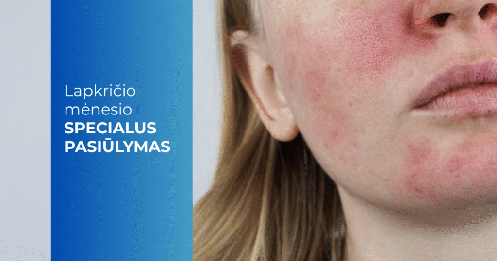 Lapkričio mėn. pasiūlymas_rožinės gydymas