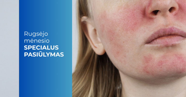 Rugsėjo mėn. pasiūlymas_Rožinės gydymas