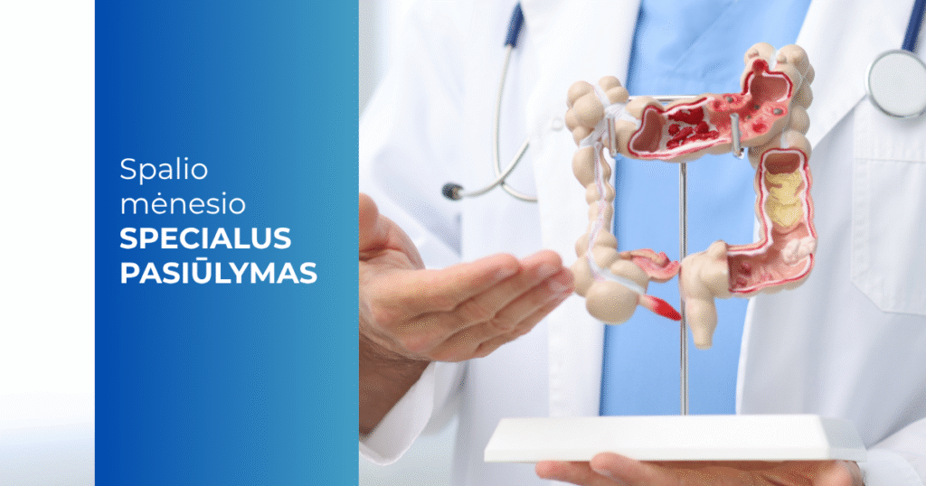 -20proc. gastroenterologinėms paslaugoms