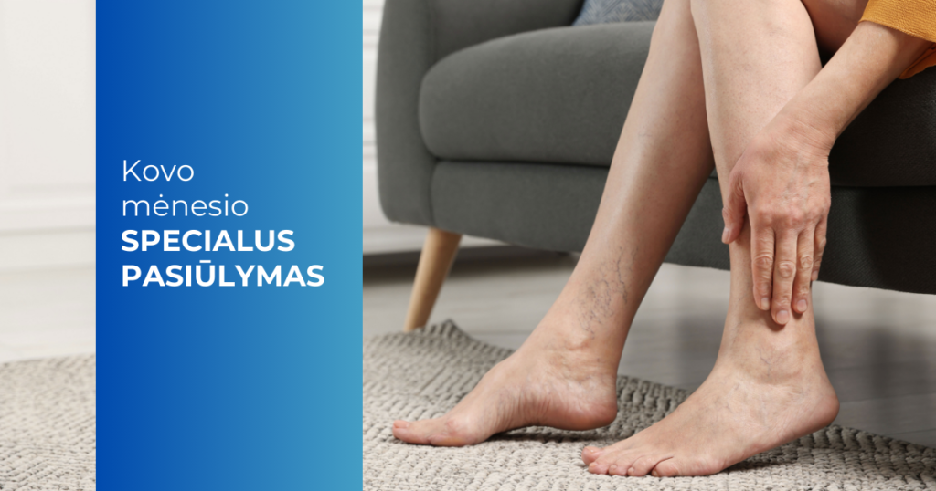 Kovo mėn. pasiūlymas_nuolaida skleroterapijai