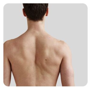 Pažastų, pečių ir nugaros plaukų šalinimas vyrams