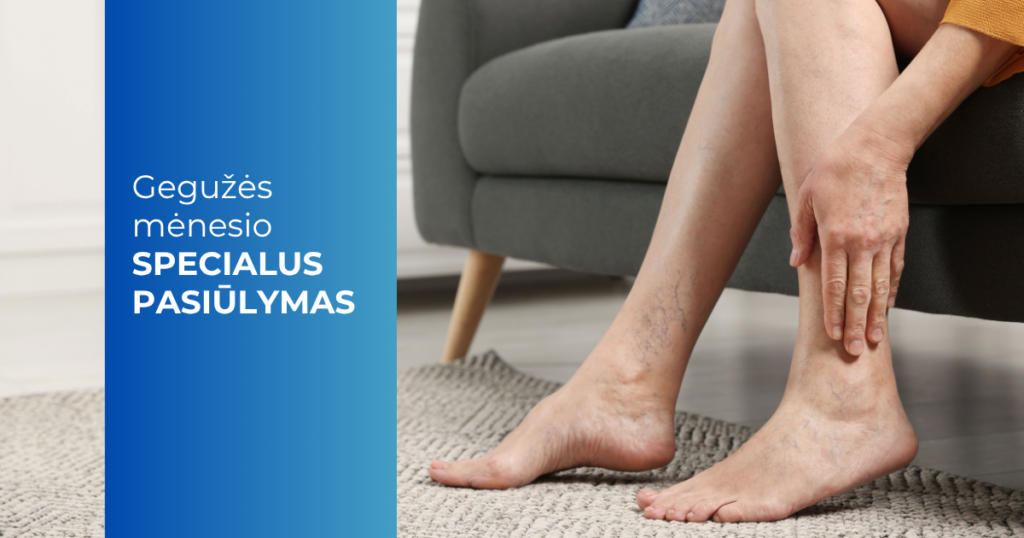 Specialus pasiūlymas_nuolaida skleroterapijai